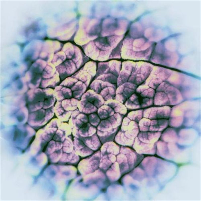 Automatisme Psychique