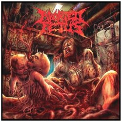 Goresoaked Clinical Accidents